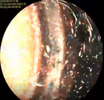 N16Aノズル約4m下